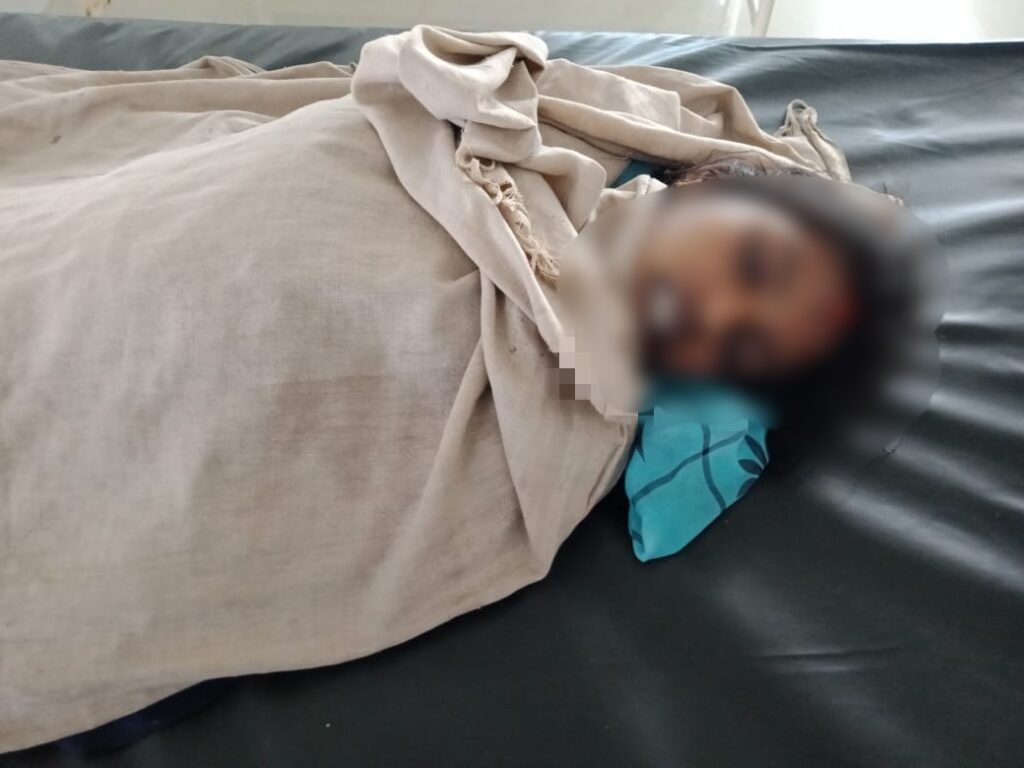 महिला ने खाया कीटनाशक दवा, ईलाज के दौरान मौत, पलामू खबर, Palamu News