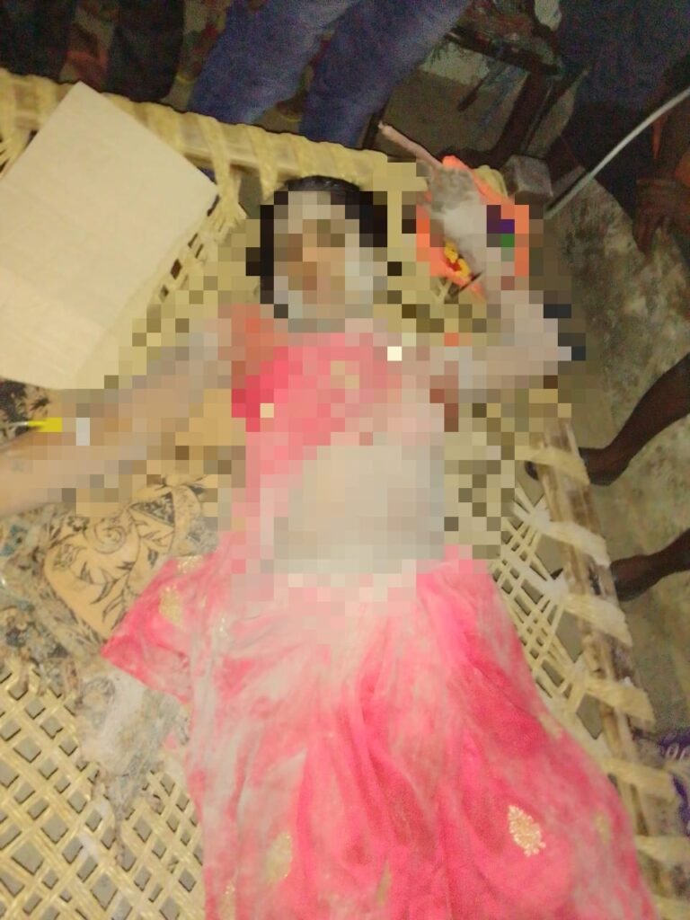बिजली  कि चपेट में आने   से 35वर्षीय महिला हुई घायल