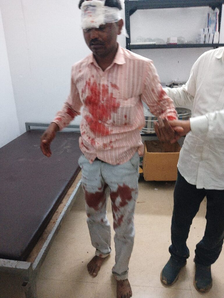 पलामू: वाहन चेकिंग के दौरान पुलिस से बचने की कोशिश में दो बाइक सवारों की आमने-सामने की टक्कर, गंभीर रूप से घायल