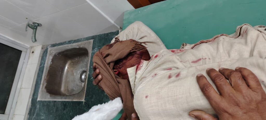 जमीन विवाद में युवक को गोली मारकर किया जानलेवा हमला, तरहसी के मिसिर दोहर गांव में दहशत